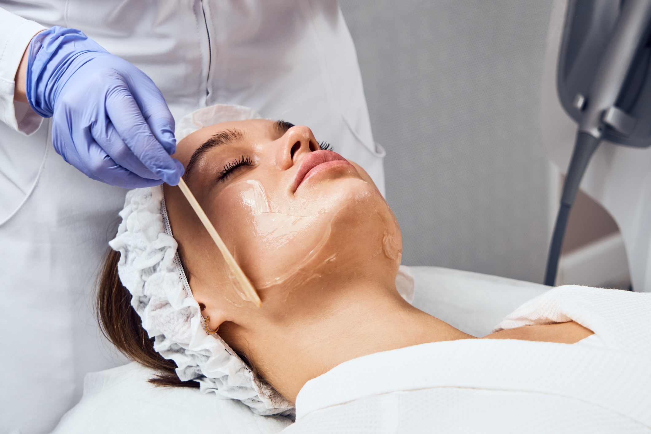 Dermal filler treatment
