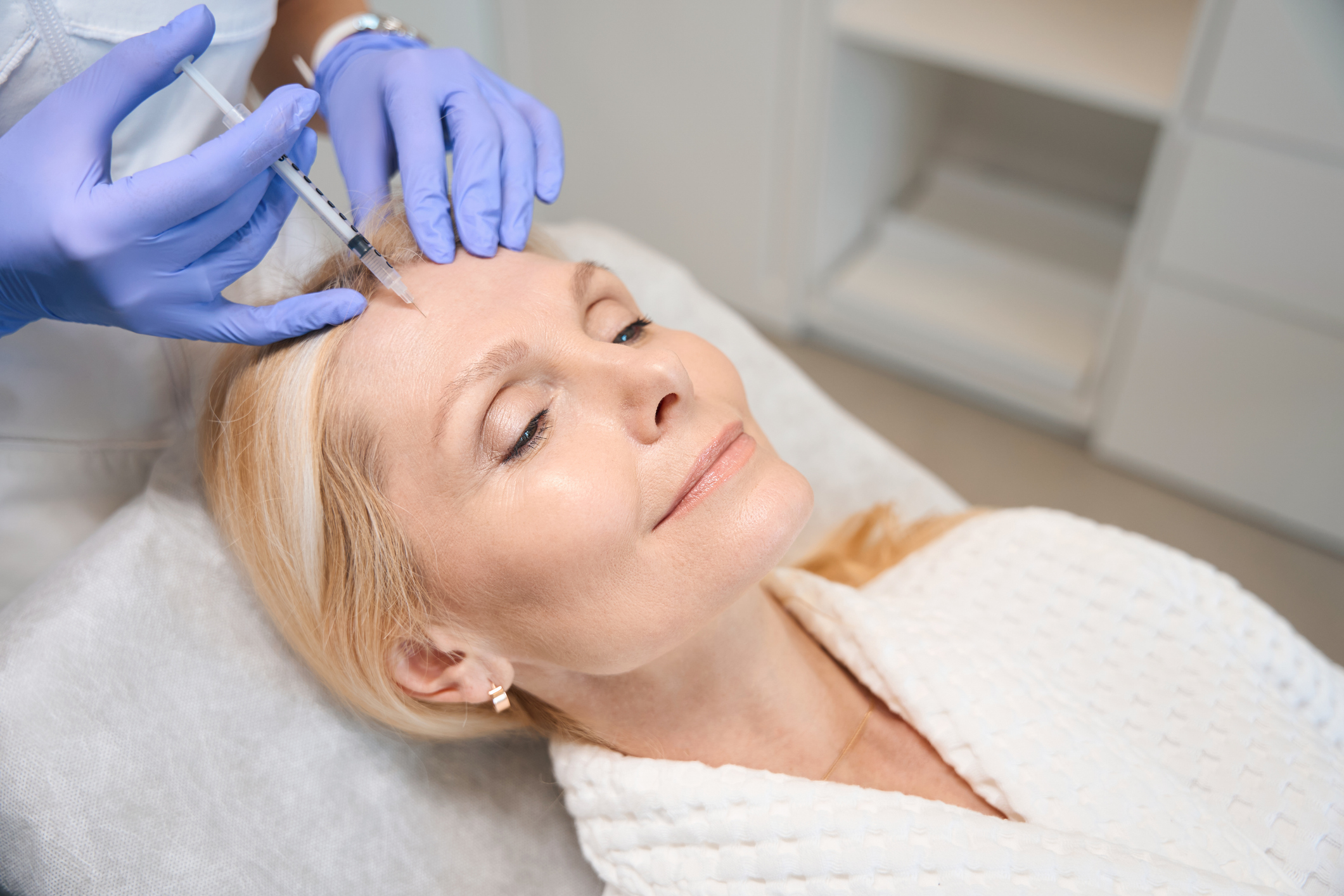 IPL photofacial treatment